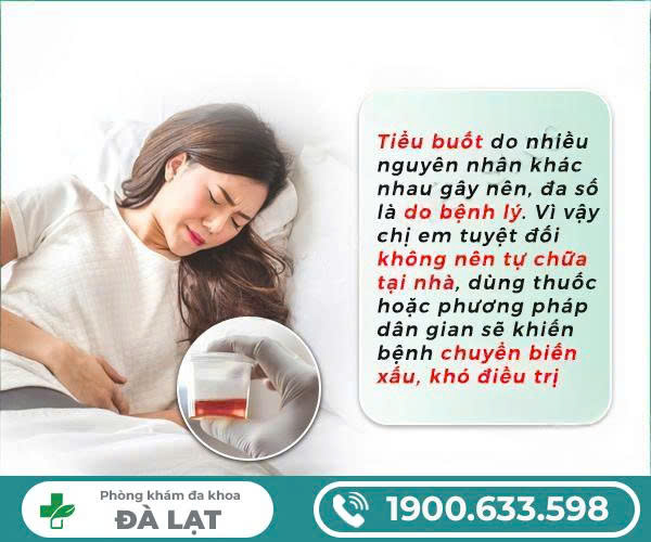 Hình ảnh minh họa